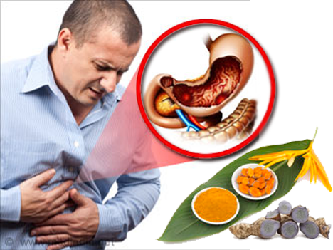 3 thảo dược quý điều trị đau dạ dày hiệu quả