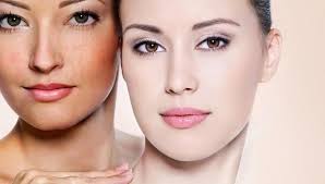 Bài thuốc chữa sạm da, nám da