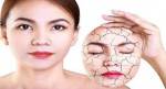 Bài thuốc phòng và trị da khô nứt nẻ
